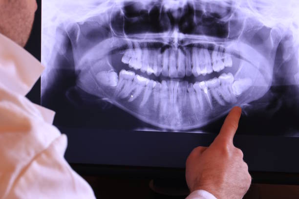 Best Emergency Treatment for Toothache in Havelock, NC